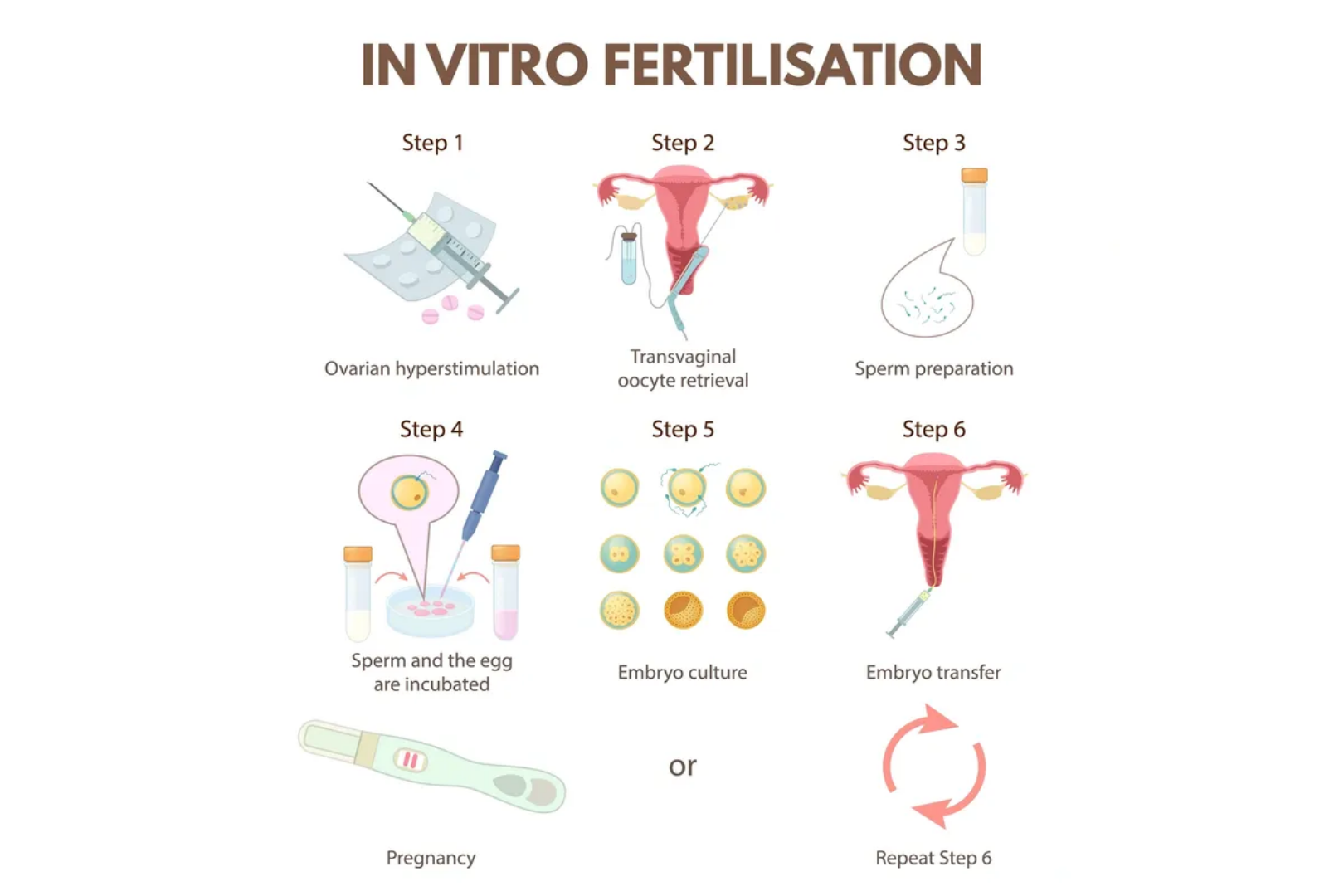 IVF
