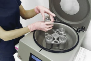 7 Days After IVF Embryo Transfer: What Symptoms Mean and What to Expect