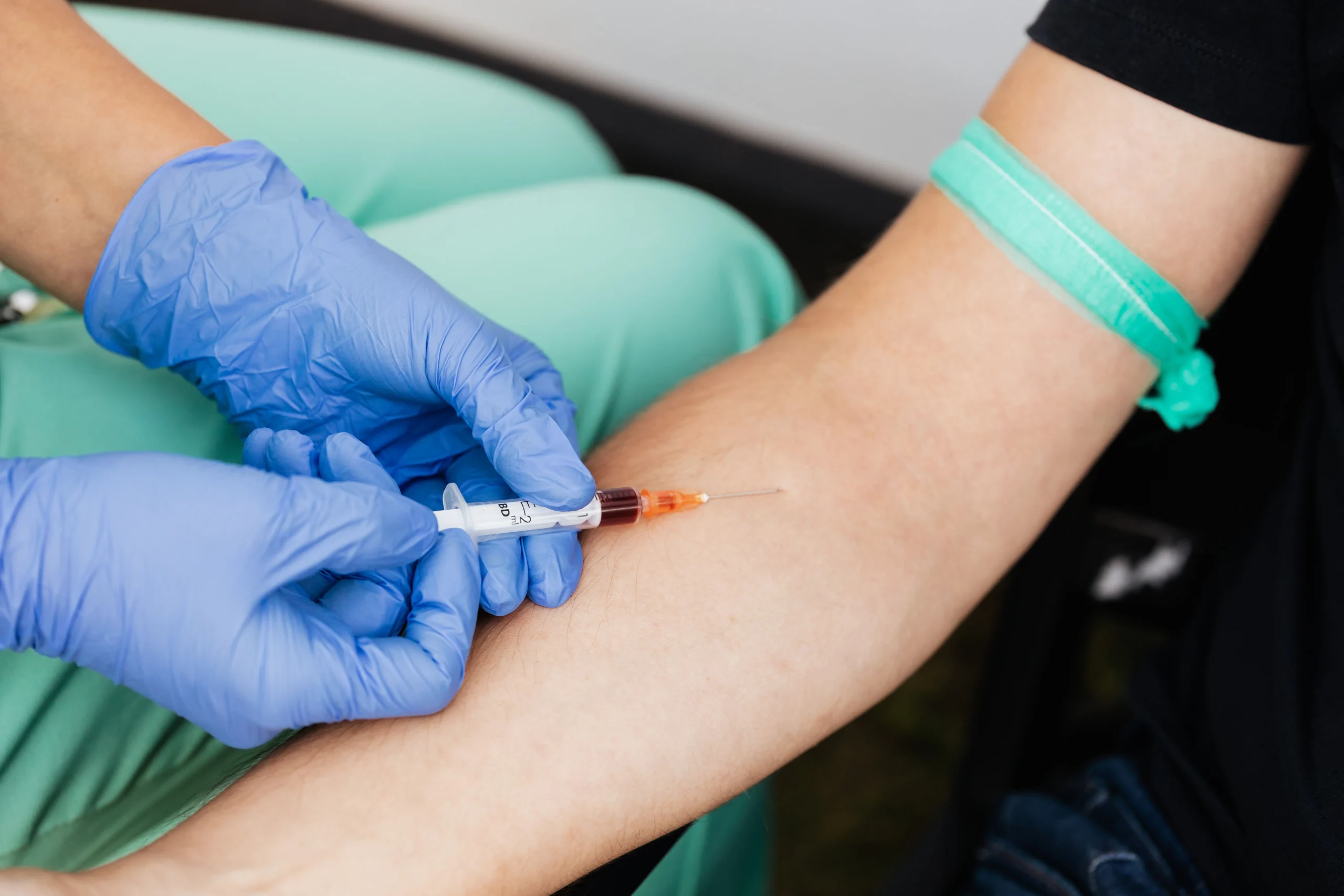 What Is PRP Treatment in IVF